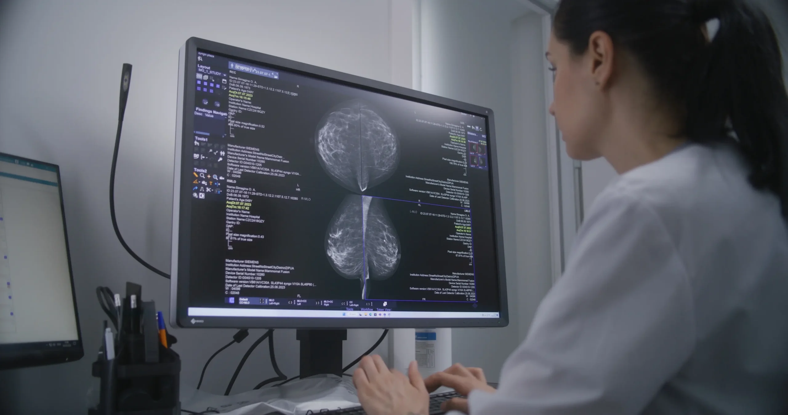 What Does Dense Breast Tissue Mean?
