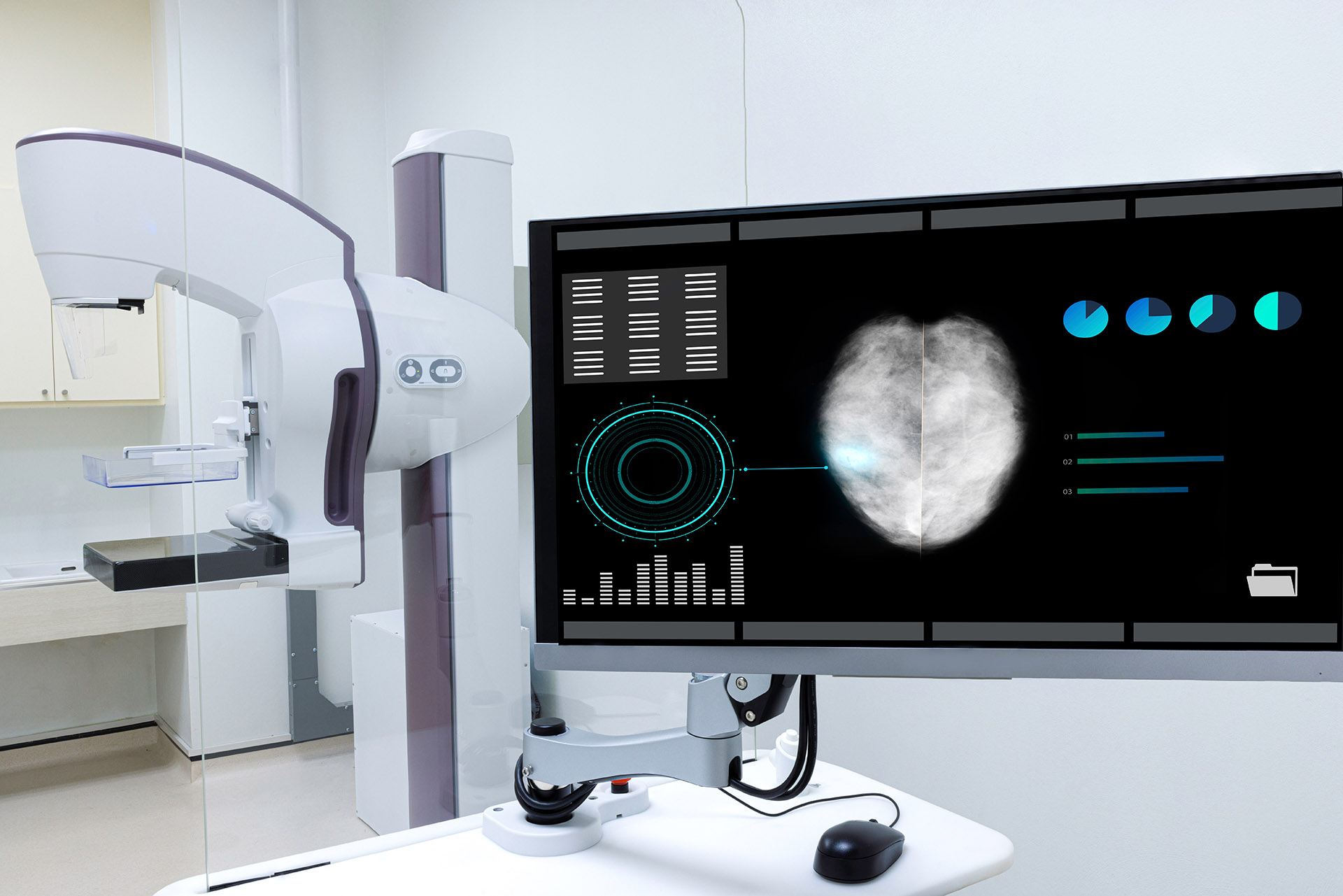 Breast Ultrasound vs Mammogram: Which is Better?